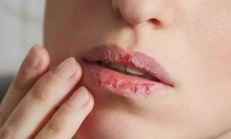 DUDAK TIRNAK YEMEK ORUCU BOZAR MI? | Oruçluyken dudak ve tırnak yemek orucu bozar mı DİYANET?- Trabzonspor